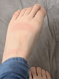 �u���O�摜