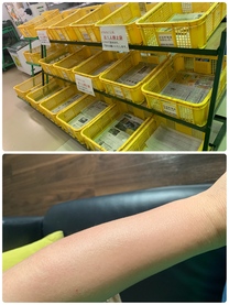 �u���O�摜