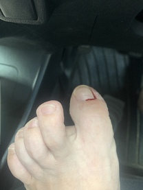 �u���O�摜