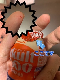 �u���O�摜