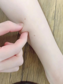 �u���O�摜