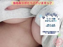 �u���O�摜