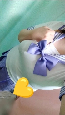 �u���O�摜