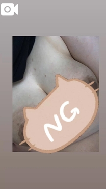 �u���O�摜