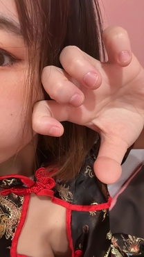 OI