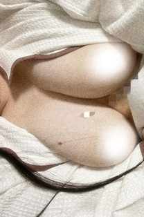 �u���O�摜