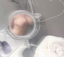 �u���O�摜