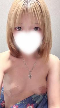 �u���O�摜