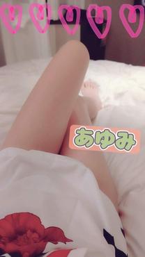 ʃL572