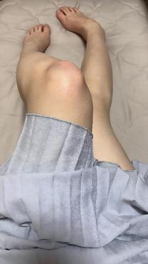 �u���O�摜