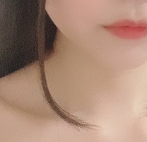 [
